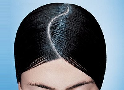 caspa belleza, cabello, pelo, trucos de belleza, caida del cabello, Chicas tips, moda cabello 2011, brillo, caspa