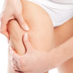 11 reglas para combatir las celulitis 4 como eliminar la celulitis