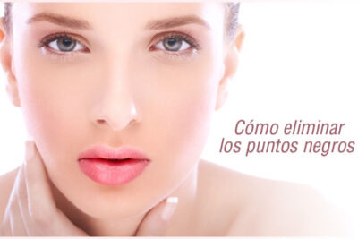 Remedios para puntos negros, trucos casi mágicos 1 Eliminar puntos negros