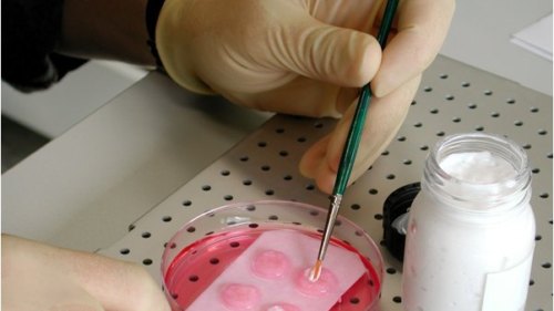 ¿Qué es la Ovodonación? - Donación de Óvulos 7 como se hace la reproduccion asistida
